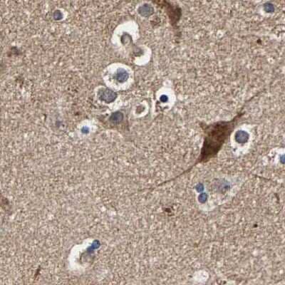 Immunohistochemistry-Paraffin: Axotrophin Antibody [NBP1-90056]