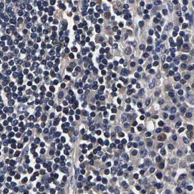 Immunohistochemistry-Paraffin: Axotrophin Antibody [NBP1-90056]