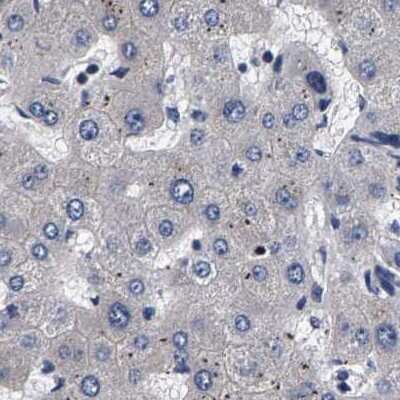 Immunohistochemistry-Paraffin: Axotrophin Antibody [NBP1-90056]