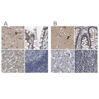 Immunohistochemistry-Paraffin: Axotrophin Antibody [NBP1-90057]
