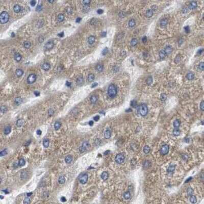 Immunohistochemistry-Paraffin: Axotrophin Antibody [NBP1-90057]