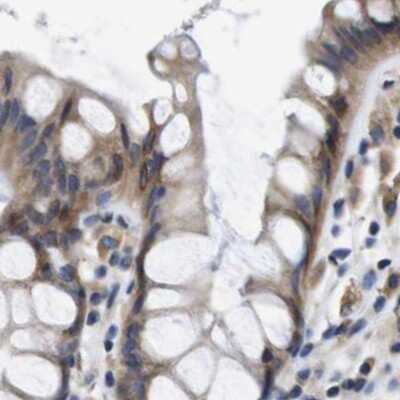 Immunohistochemistry-Paraffin: Axotrophin Antibody [NBP1-90057]