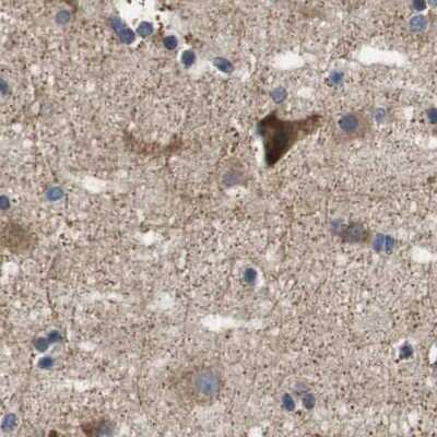 Immunohistochemistry-Paraffin: Axotrophin Antibody [NBP1-90057]