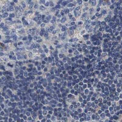 Immunohistochemistry-Paraffin: Axotrophin Antibody [NBP1-90057]