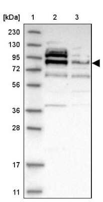 Western Blot: Axotrophin Antibody [NBP1-90056]