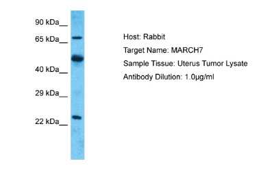 Western Blot: Axotrophin Antibody [NBP2-76664]