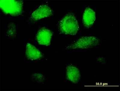 Immunocytochemistry/ Immunofluorescence: Azurocidin/CAP37/HBP Antibody [H00000566-B01P]