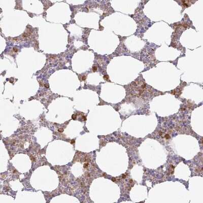 Immunohistochemistry-Paraffin: Azurocidin/CAP37/HBP Antibody [NBP2-31613]