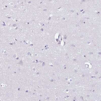 Immunohistochemistry-Paraffin: Azurocidin/CAP37/HBP Antibody [NBP2-31613]