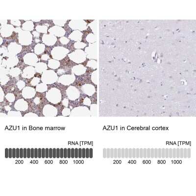 Immunohistochemistry-Paraffin: Azurocidin/CAP37/HBP Antibody [NBP2-31613]