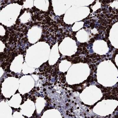 Immunohistochemistry-Paraffin: Azurocidin/CAP37/HBP Antibody [NBP3-16991]