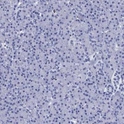 Immunohistochemistry-Paraffin: Azurocidin/CAP37/HBP Antibody [NBP3-16991]
