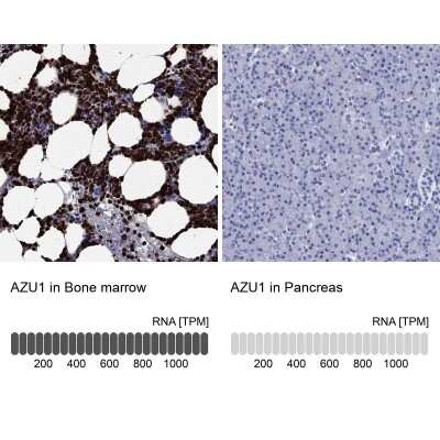 Immunohistochemistry-Paraffin: Azurocidin/CAP37/HBP Antibody [NBP3-16991]