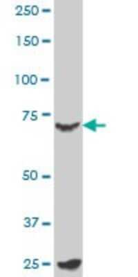 Western Blot: B-Myb Antibody (1C7) [H00004605-M02]