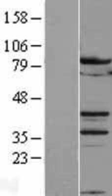 Western Blot: B-Myb Overexpression Lysate [NBL1-13412]