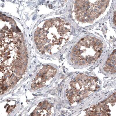 Immunohistochemistry-Paraffin: B-Raf Antibody (CL4003) [NBP2-59034]