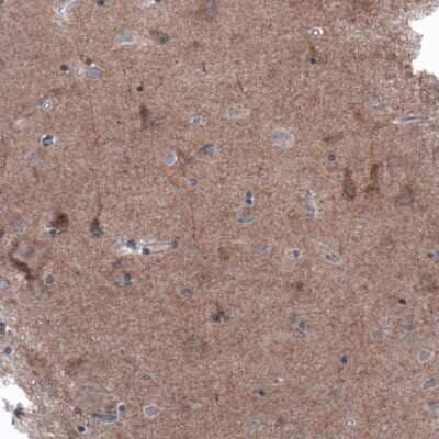 Immunohistochemistry-Paraffin: B-Raf Antibody (CL4003) [NBP2-59034]