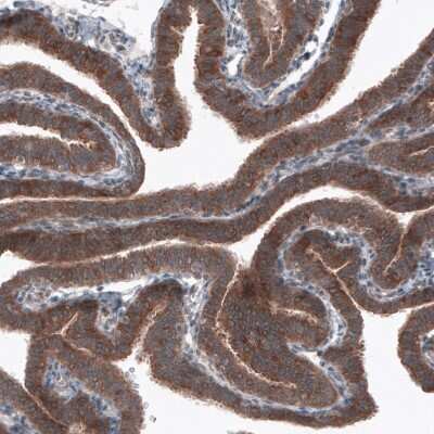 Immunohistochemistry-Paraffin: B-Raf Antibody (CL4003) [NBP2-59034]