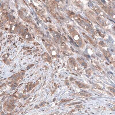 Immunohistochemistry-Paraffin: B-Raf Antibody (CL4003) [NBP2-59034]