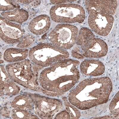 Immunohistochemistry-Paraffin: B-Raf Antibody (CL4004) [NBP2-59035]
