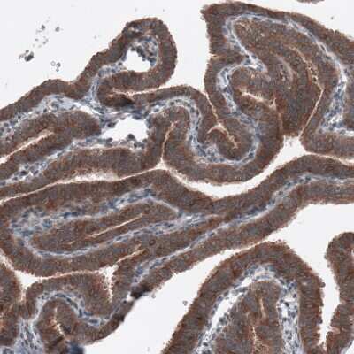 Immunohistochemistry-Paraffin: B-Raf Antibody (CL4004) [NBP2-59035]