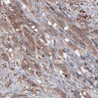 Immunohistochemistry-Paraffin: B-Raf Antibody (CL4004) [NBP2-59035]