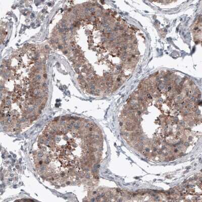 Immunohistochemistry-Paraffin: B-Raf Antibody (CL4004) [NBP2-59035]