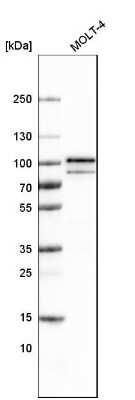 Western Blot: B-Raf Antibody (CL4004) [NBP2-59035]