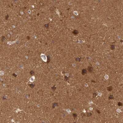 Immunohistochemistry-Paraffin: B-Raf Antibody [NBP1-89942]