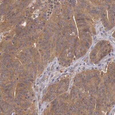 Immunohistochemistry-Paraffin: B-Raf Antibody [NBP1-89942]