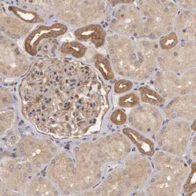 Immunohistochemistry-Paraffin: B-Raf Antibody [NBP1-89942]
