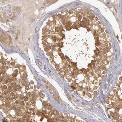 Immunohistochemistry-Paraffin: B-Raf Antibody [NBP1-89942]