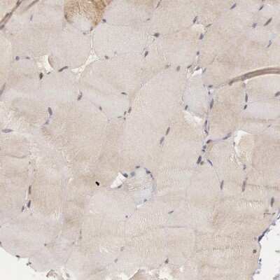 Immunohistochemistry-Paraffin: B-Raf Antibody [NBP1-89942]