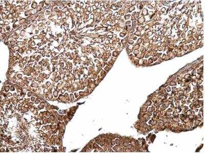 Immunohistochemistry-Paraffin: B-Raf Antibody [NBP2-15531]