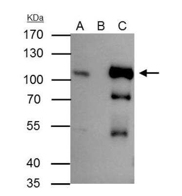 Immunoprecipitation: B-Raf Antibody [NBP2-15531]