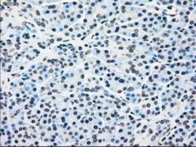 Immunohistochemistry: B-Raf Antibody (OTI5A9) - Azide and BSA Free [NBP2-70260]