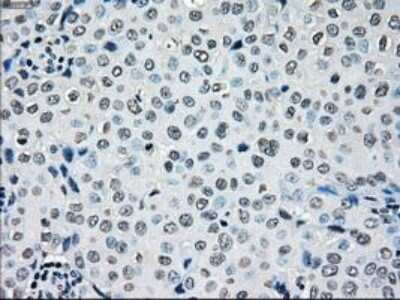Immunohistochemistry-Paraffin: B-Raf Antibody (OTI5A9) [NBP1-47668]