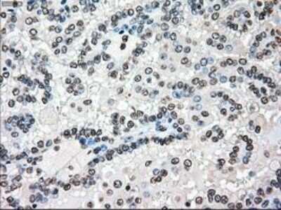 Immunohistochemistry-Paraffin: B-Raf Antibody (OTI5A9) [NBP1-47668]