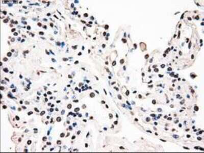 Immunohistochemistry-Paraffin: B-Raf Antibody (OTI5A9) [NBP1-47668]