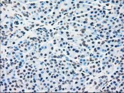 Immunohistochemistry-Paraffin: B-Raf Antibody (OTI5A9) [NBP1-47668]