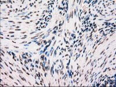 Immunohistochemistry-Paraffin: B-Raf Antibody (OTI5A9) [NBP1-47668]