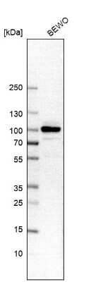 Western Blot: B-Raf Antibody [NBP2-58818]