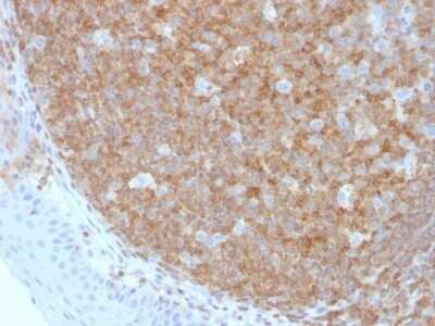 Immunohistochemistry-Paraffin: B220/CD45R Antibody (F10-89-4) - Azide and BSA Free [NBP2-54455]