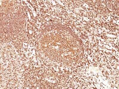 Immunohistochemistry-Paraffin: B220/CD45R Antibody (F10-89-4) [NBP2-53175]