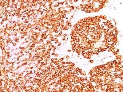 Immunohistochemistry-Paraffin: B220/CD45R Antibody (PTPRC/1460) [NBP2-53171]