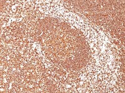 Immunohistochemistry-Paraffin: B220/CD45R Antibody (PTPRC/1461) [NBP2-53174]