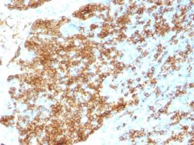Immunohistochemistry-Paraffin: B220/CD45R Antibody (PTPRC/1783R) - Azide and BSA Free [NBP2-54578]