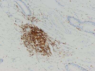 Immunohistochemistry-Paraffin: B220/CD45R Antibody (PTPRC/1783R) [NBP2-53303]