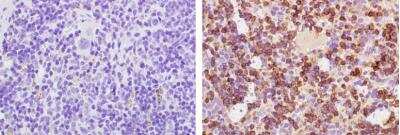 Immunohistochemistry: B220/CD45R Antibody (RM0063-9F14) - Azide and BSA Free [NBP2-12168]