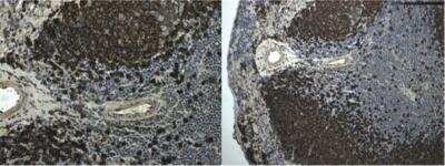 Immunohistochemistry-Paraffin: B220/CD45R Antibody (RM0063-9F14) - Azide and BSA Free [NBP2-12168]